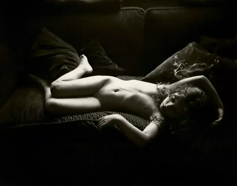 Sally Mann, Dog Scratches, 1991